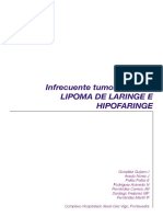 Infrecuente Tumor Benigno: Lipoma de Laringe E Hipofaringe