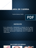 Displasia de Cadera