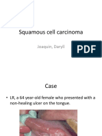 Squamous Cell Carcinoma of the Tongue: A Case Report