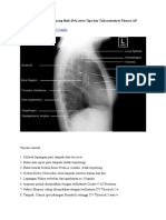 10 Kriteria Foto Thorax Yang Baik