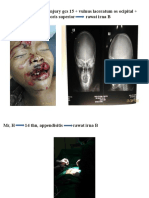 MR, R 9 THN, Head Injury Gcs 15 + Vulnus Laceratum Os Ocipital + Vulnus Laceratum Regio Oris Superior Rawat Irna B