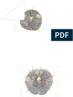 Brainstem Slides With Overlay