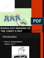 Radiology-Imaging of The Chest X Ray