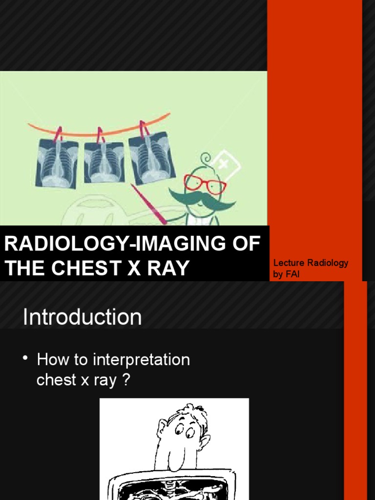 Radiology-Imaging of The Chest X Ray | PDF