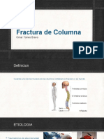 Fractura de Columna