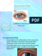 Conjuctivitis