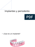 implantes y periodonto ..pptx