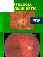 Patologia Nervului Optic