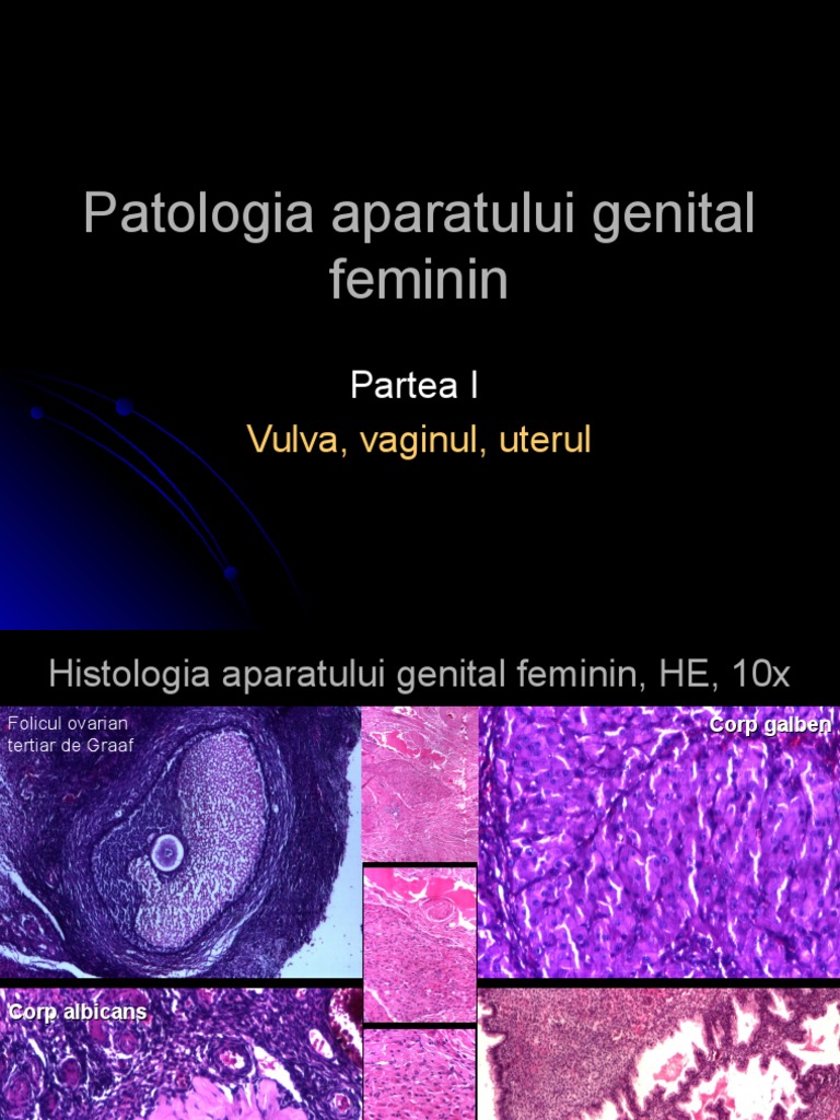 Curs 6 Patologia Aparatului Genital Feminin I | PDF
