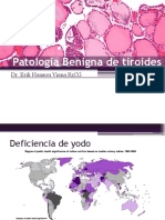 Patologia Benigna de Tiroides