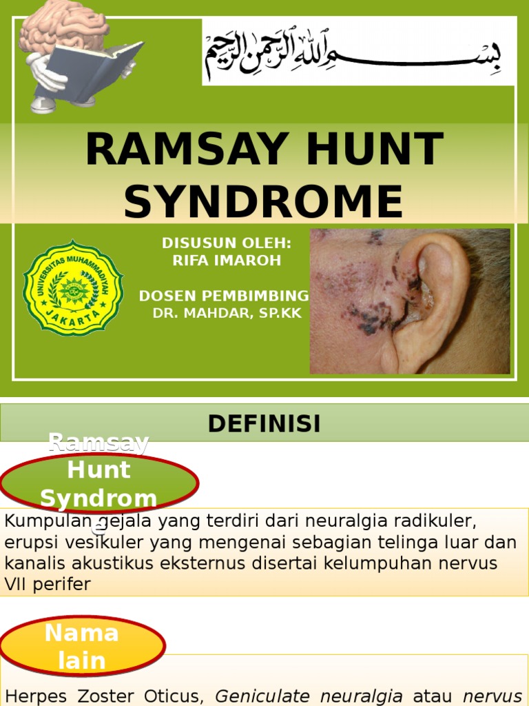 Ramsay Hunt Syndrome | PDF