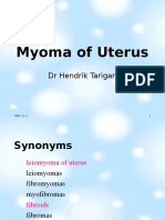 Myoma of Uterus: DR Hendrik Tarigan