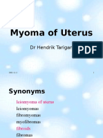 Uterine Leiomyomas Guide