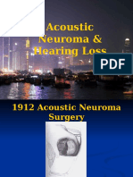 Acoustic Neuroma Acoustic Neuroma & Hearing Loss