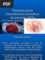 Aula Placenta Previa Dpp