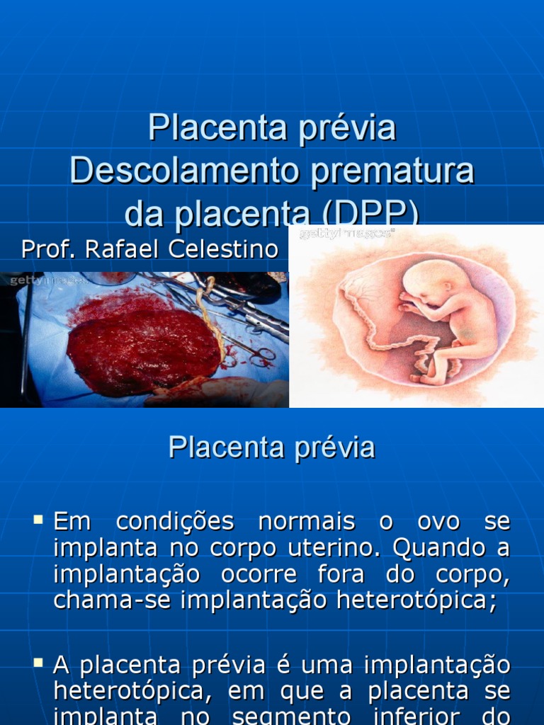 Aula Placenta Previa DPP | Placenta | Gravidez