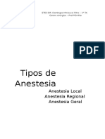 Tipos de Anestesia
