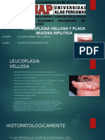 Leucoplasia Vellosa y Placa Mucosa Sifilitica