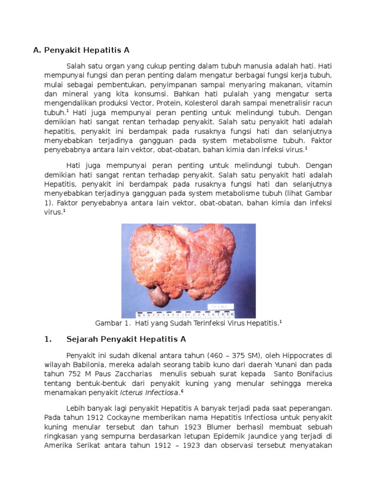 Penyakit Hepatitis A