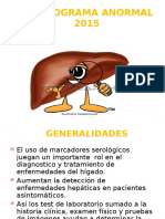 Hepatograma Anormal