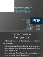 frenectomiaefrenotomia-140526022315-phpapp02