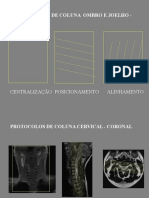 PROTOCOLOS DE COLUNA CERVICAL - SAGITAL.ppt