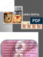Caries Dental15