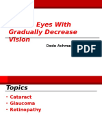 Normal Eyes With Gradually Decrease Vision: Dede Achmad Basof