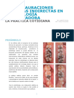 Las Restauraciones Estéticas Indirectas en Odontología Conservadora Dr. Alberto Pujia Odt. Paolo Riccioni Es