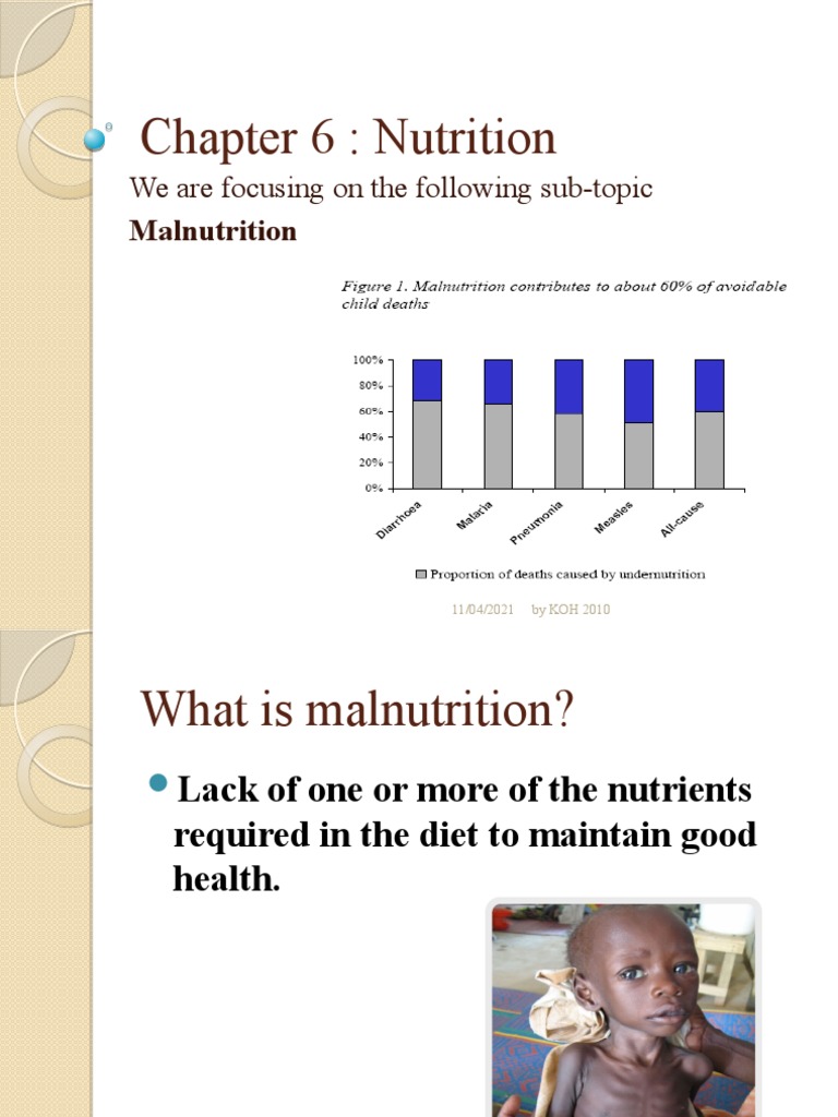 Understanding Malnutrition Causes and Effects | PDF | Wellness