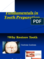 Fundamentals in Tooth Preparation