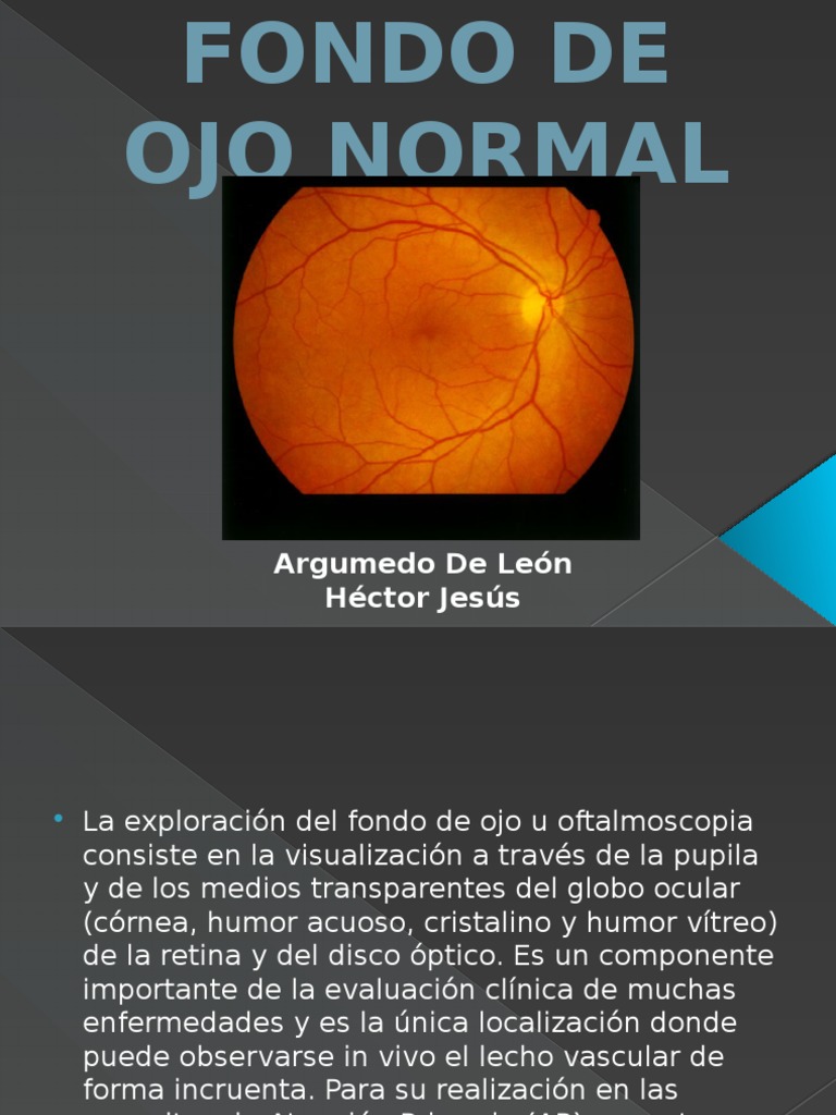 Exploración del Fondo de Ojo Normal | PDF | Ojo humano | Rasgos faciales