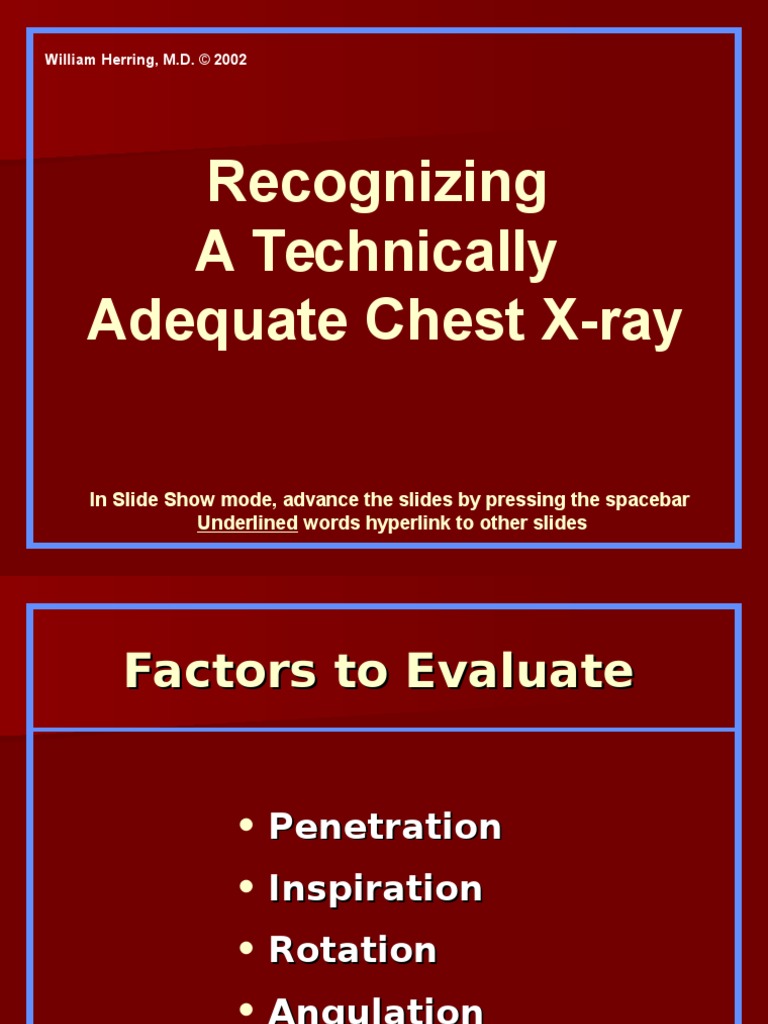 Recognizing A Technically Adequate Chest XRay PDF Anatomical Terms