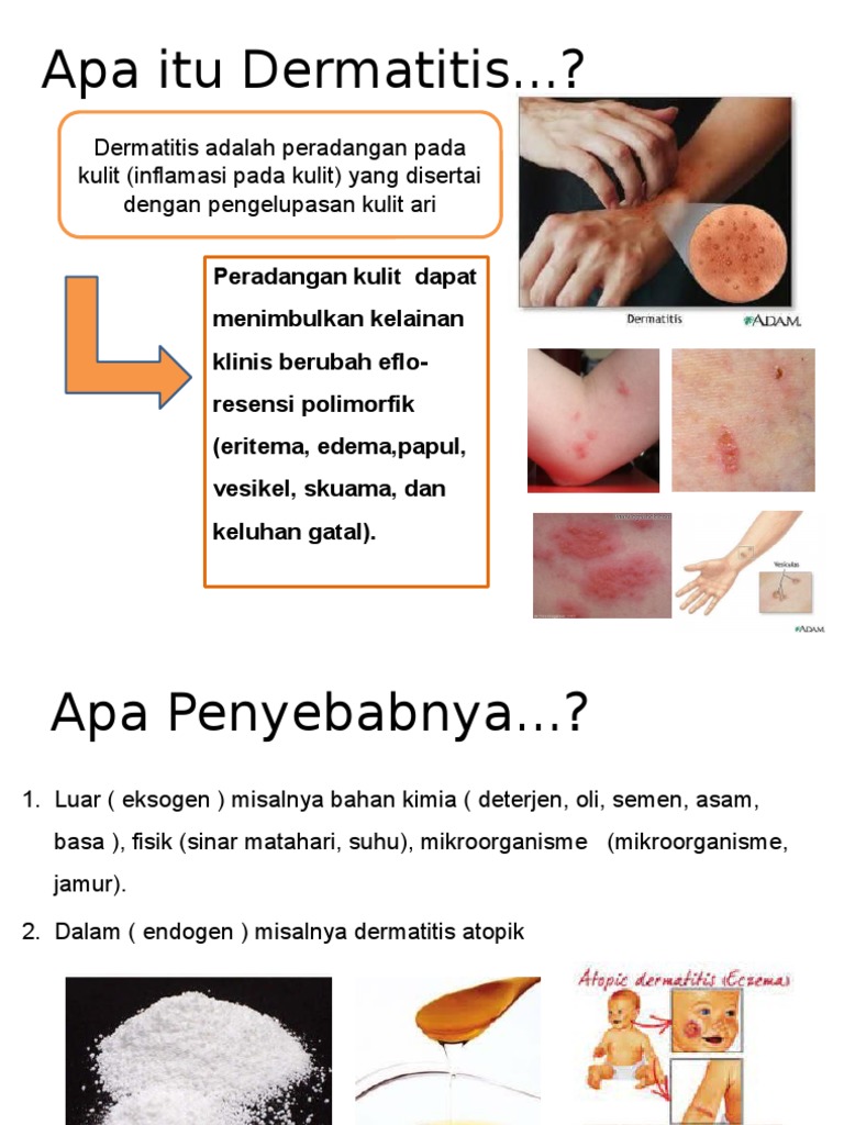 Apa Itu Dermatitis PDF