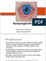 Konjungtivitis