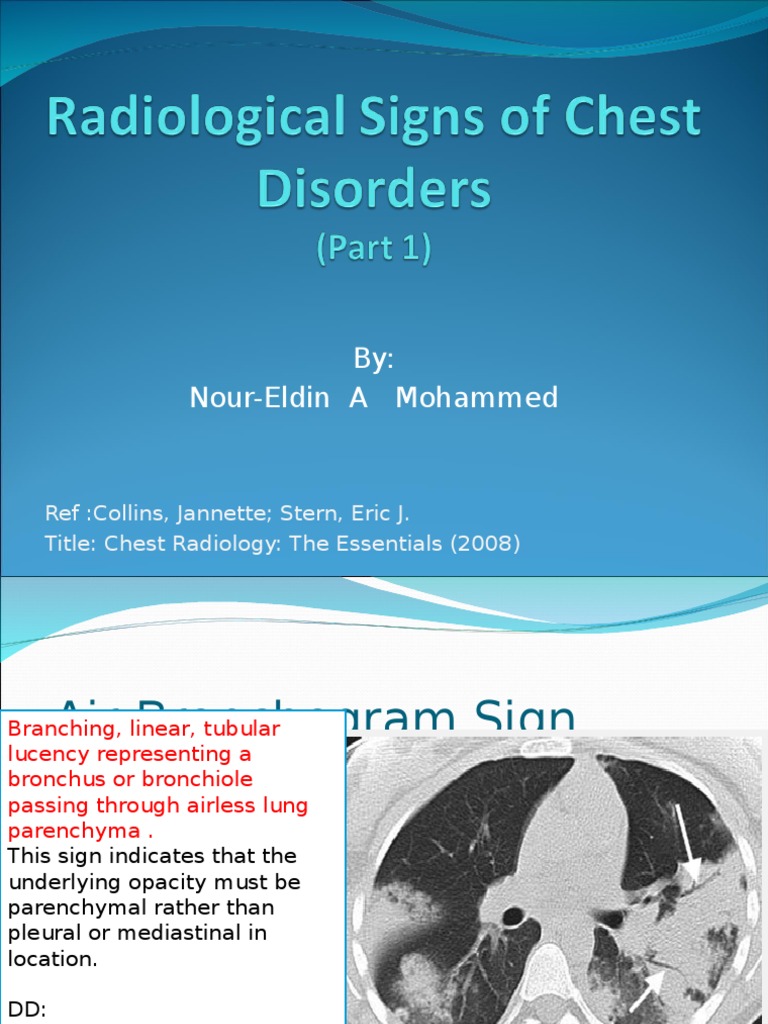 Key Chest Radiology Signs Explained | PDF | Lung | Thorax
