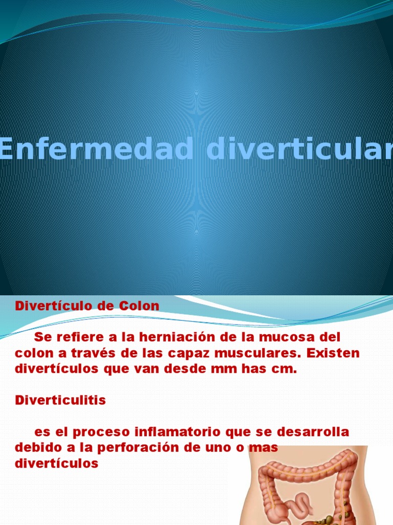 Diverticulitis | PDF | Enfermedades y trastornos | Especialidades Medicas