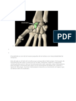 fractura_escafoides