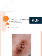 CURACION SIMPLE y AVANZADA ACTUALIZADA.2016 PDF