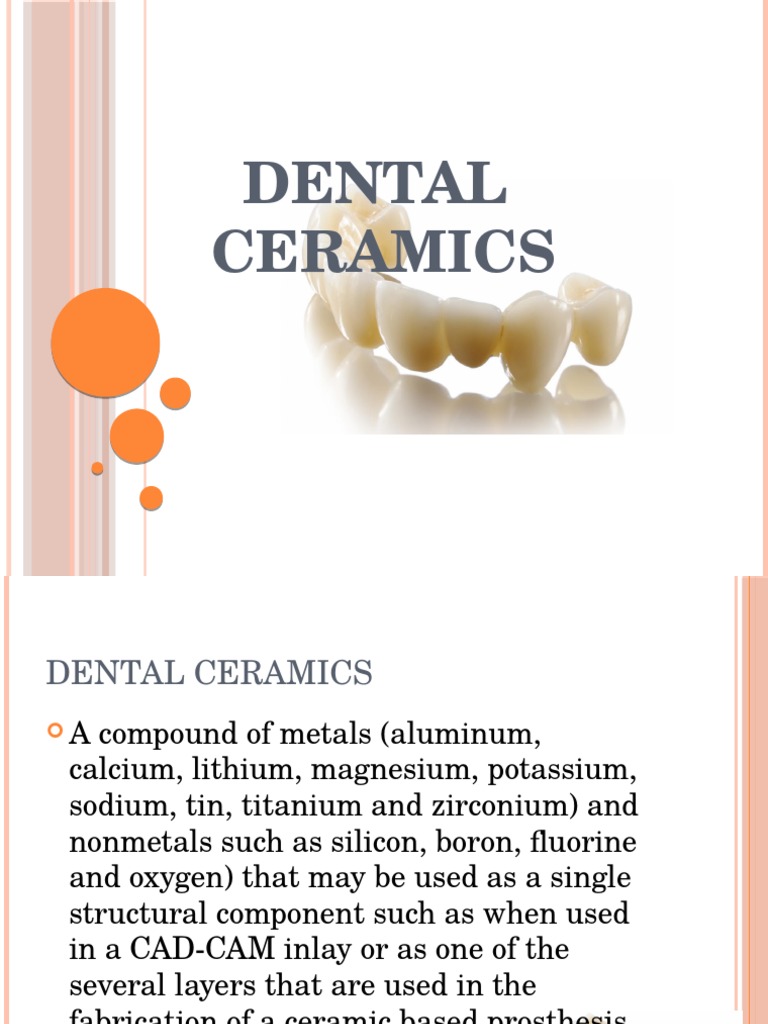 DENTAL Ceramics Ppt Strength Of Materials Glasses