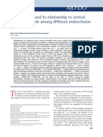 Curve of Spee and Its Relationship To Vertical Eruption of Teeth Among Different Malocclusion Groups