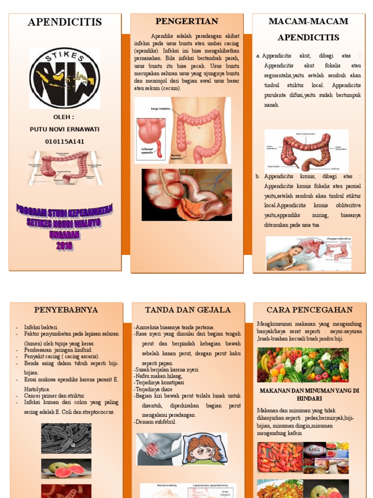 Tanda dan Gejala Apendisitis Akut | PDF | Kesehatan Holistik | Sains ...