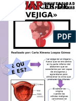 Cancer de Vejiga