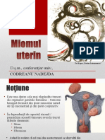 Miomul uterin