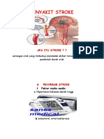 Penyakit Stroke