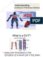 DVT & Pulmonary Embolus