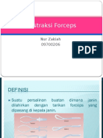 Ekstraksi Forceps