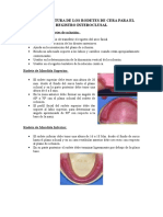 Grosor y Altura de Los Rodetes de Cera para El Registro Interoclusal