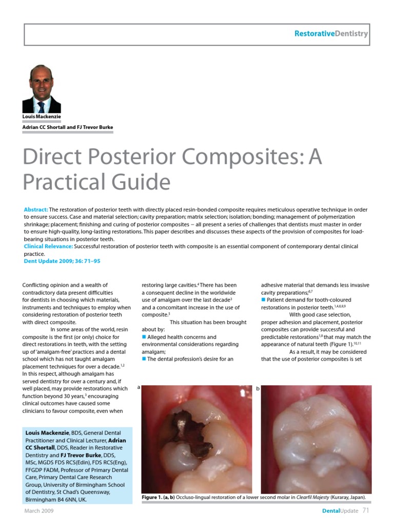 Posterior Composite Dental Composite Tooth Enamel