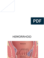 Pics Hemoroid